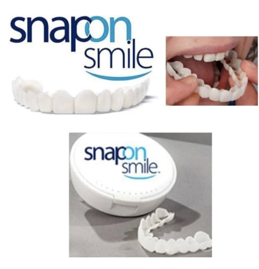 Carillas de Silicona Snap-On Smile™ | Sonrisa Impecable en Segundos y Sin Dolor