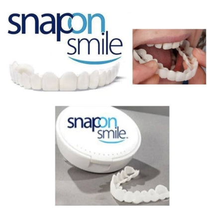 Carillas de Silicona Snap-On Smile™ | Sonrisa Impecable en Segundos y Sin Dolor